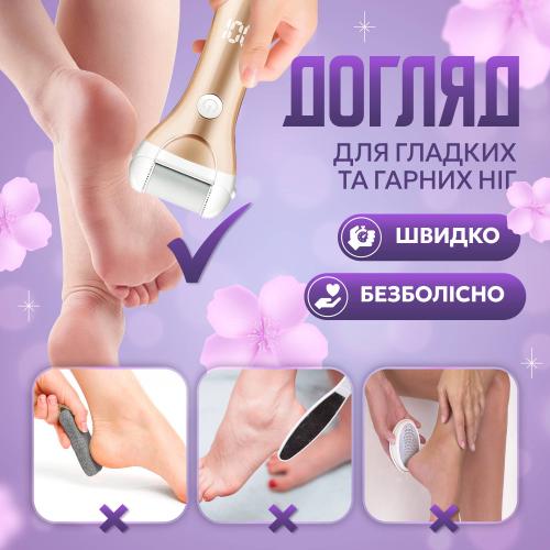 Комплект змінних насадок для роликової пемзи No Brand 3 шт (ZCA-3) Комплект змінних насадок для роликової пемзи No Brand 3 шт (ZCA-3)