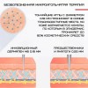 Дермапен Dr. Pen 6 Режимів + 4 Насадки Електричний Мезороллер М8 Сірий (402)