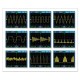 Осцилограф цифровий портативний з акумулятором KKMOON DS0120M, 120 МГц 500 Мб / с, генератор сигналу