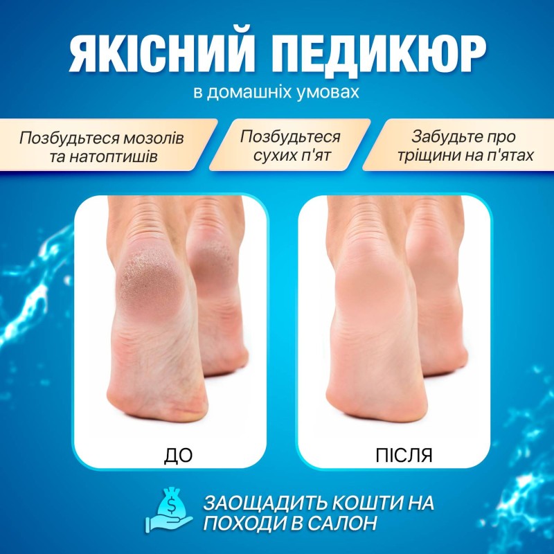 Електрична пемза для ніг No Brand (CRMJ-011)