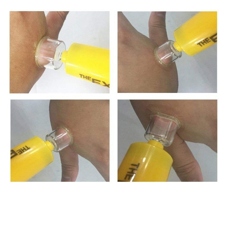 Екстрактор отрути - набір першої допомоги при укусах змій Sawyer extractor pump kit