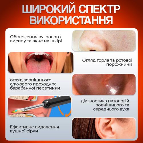 Пристрій для видалення вушної сірки з камерою Brillix 1296P Чорный (PO-Black) Пристрій для видалення вушної сірки з камерою Brillix 1296P Чорный (PO-Black)