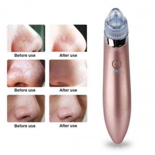 Вакуумний очищувач шкіри обличчя Beauty skin XN-8030 SMT 212732101 Вакуумний очищувач шкіри обличчя Beauty skin XN-8030 SMT 212732101
