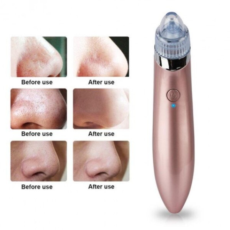 Вакуумний очищувач шкіри обличчя Beauty skin XN-8030 SMT 212732101
