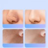 Ультразвуковий скрабер для очищення обличчя Skin Tech Scrubber 3305 Білий (3305O)