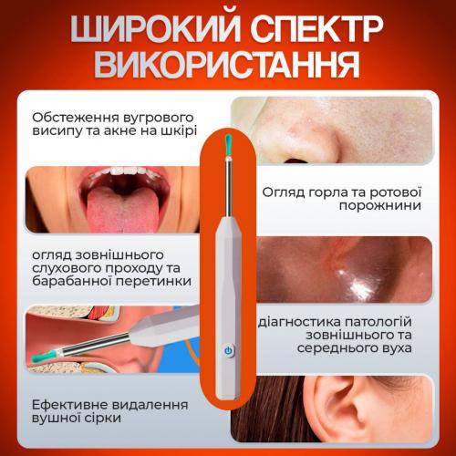 Пристрій для видалення вушної сірки з камерою Brillix 1296P Білий (PO-White)