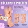 Комплект змінних насадок для роликової пемзи No Brand 3 шт (ZCA-3)