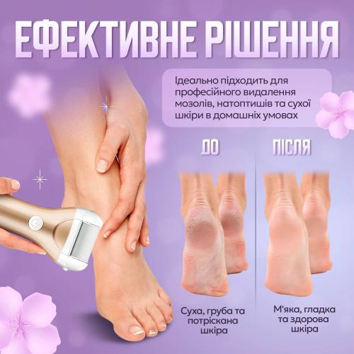 Комплект змінних насадок для роликової пемзи No Brand 3 шт (ZCA-3) Комплект змінних насадок для роликової пемзи No Brand 3 шт (ZCA-3)