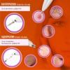 Електрокоагулятор плазмовий для видалення папілом бородавок No Brand Mini Freckle Білий (MF-Pen)