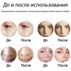 Мезоролер для обличчя AIW 75 Skin Roller System 540 голок довжина голки 0.75 мм Black (n-55)