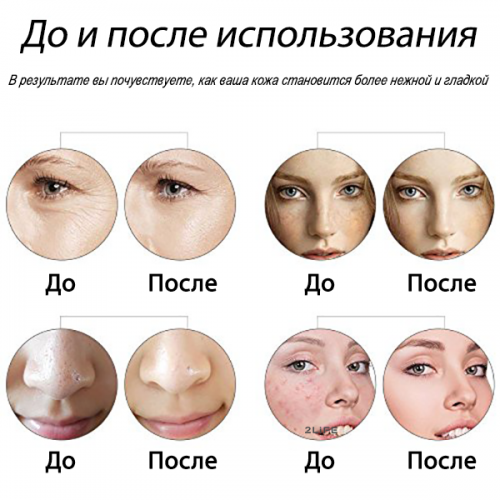 Мезоролер для обличчя AIW 75 Skin Roller System 540 голок довжина голки 0.75 мм Black (n-55) в інтернет супермаркеті PbayMarket!