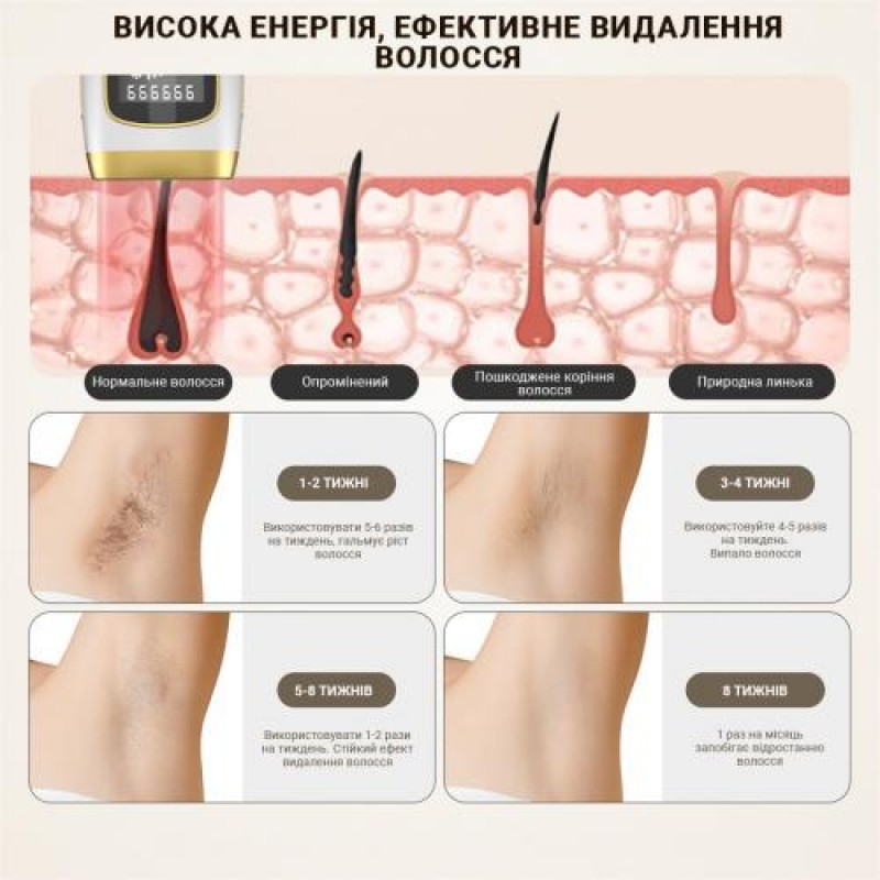 Фотоепілятор з функцією охолодження Inspire Sapphire 999999 Black (XM-L011Bk)