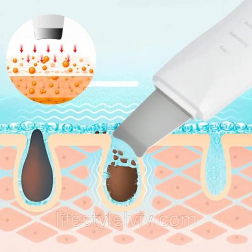 Ультразвуковий скрабер для очищення обличчя Skin Tech Scrubber 3305 Білий (3305O) Ультразвуковий скрабер для очищення обличчя Skin Tech Scrubber 3305 Білий (3305O)