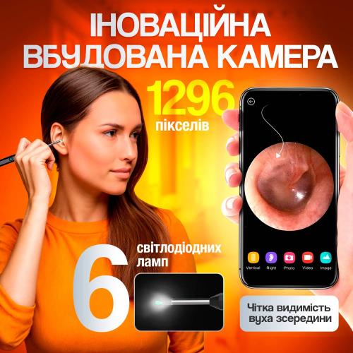Пристрій для видалення вушної сірки з камерою Brillix 1296P Чорный (PO-Black) Пристрій для видалення вушної сірки з камерою Brillix 1296P Чорный (PO-Black)