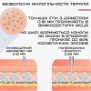 Бездротовий Дермапен Dr. Pen 6 Режимів Дермаштамп Електричний На Акумуляторі М8 Сірий (684)