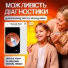 Пристрій для видалення вушної сірки з камерою Brillix 1296P Білий (PO-White)