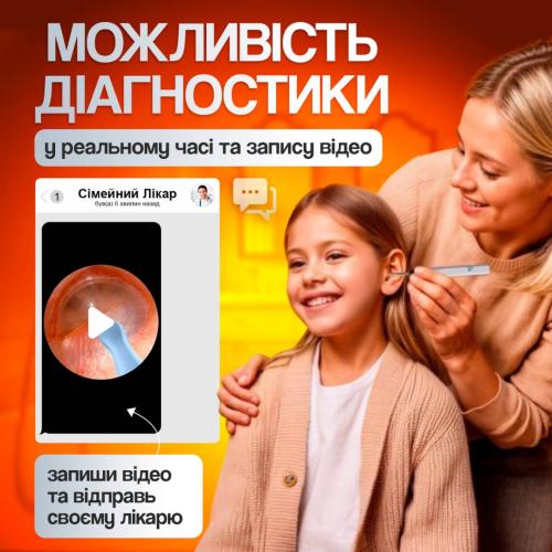 Пристрій для видалення вушної сірки з камерою Brillix 1296P Білий (PO-White)