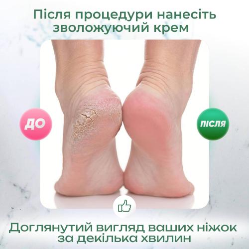 Електрична пемза для ніг CR 02 17х7,5 см Електрична пемза для ніг CR 02 17х7,5 см